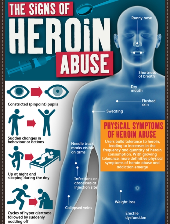 the signs of heroin abuse