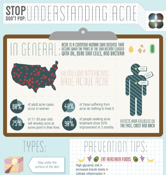stop don’t pop understanding acne 1