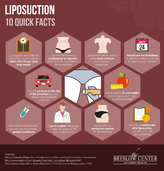 liposuction