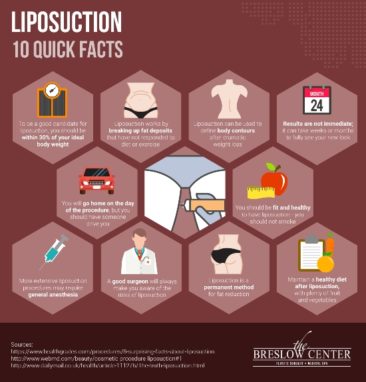 Quick Facts About Liposuction